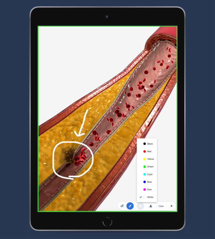 The BioDigital Human offers collaboration tools that allow you to whiteboard, markup, and customize 3D models. title=